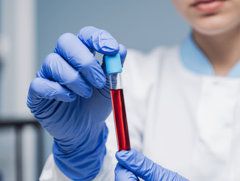 Повышенный креатинин