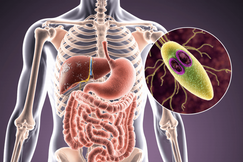 Лямблиоз — симптомы и лечение